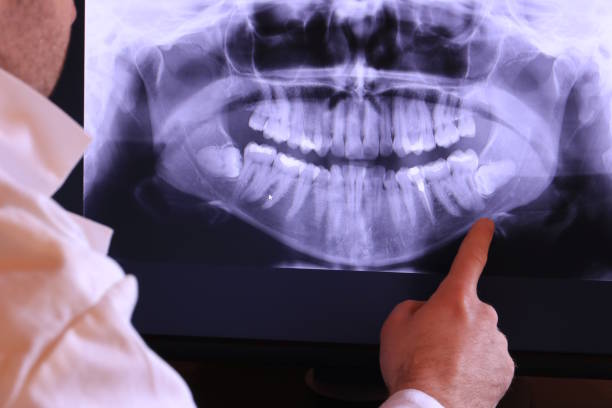 Best Dental Abscess Treatment in Crest Hl, IL