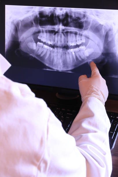 Best Emergency Root Canal Therapy in Crest Hl, IL